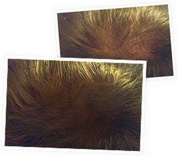 Спрей для восстановления и роста волос Ultra Hair Spray Syst