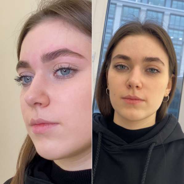 Комплекс бровей в Москве фото 4
